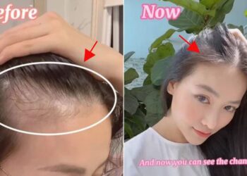 Nước vo gạo đừng đổ đi, dùng làm dung dịch dưỡng giúp tóc mọc dày, đến Hoa hậu Trái đất cũng phải thử