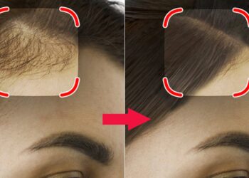 5 mẹo nhất định nên biết để tóc mọc khỏe và dày hơn