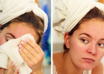 Sau khi rửa mặt, lau khô bằng khăn có ảnh hưởng rất xấu đến da