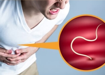 Tẩy giun có cần thiết không và ai nên tẩy giun?